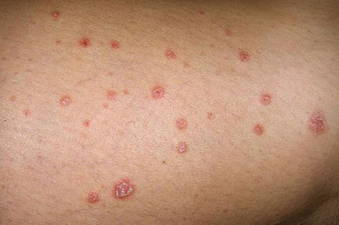 Thú cưng bị nấm da có lây sang người không? Cách phòng tránh 3
