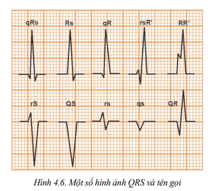 A graph of a heart beat

Description automatically generated