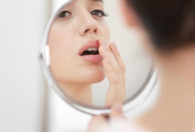 Women cold sores
