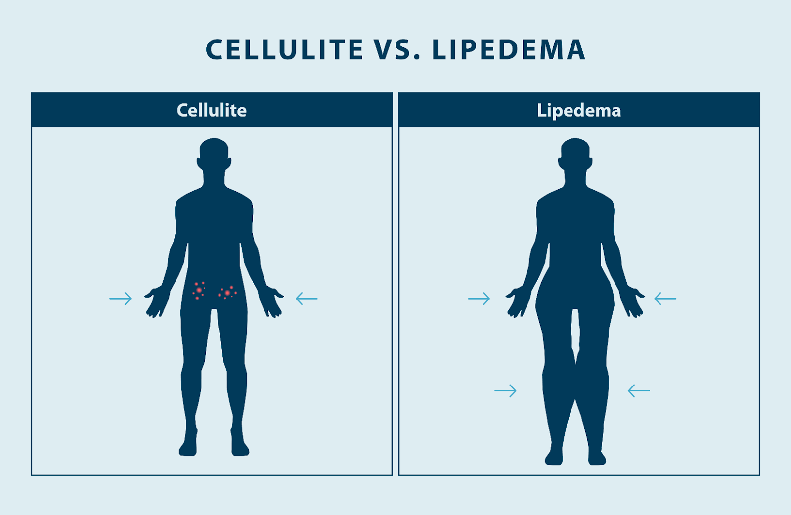 A comparison of a person's body

Description automatically generated