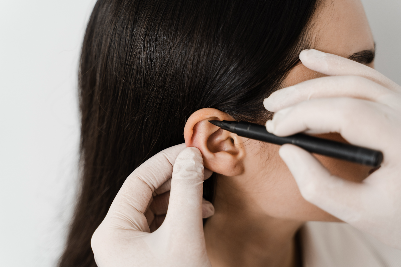 A close-up of a doctor using a marker to draw surgical guidelines on a woman's ear, outlining the area for an otoplasty procedure.