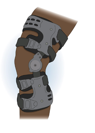 Nü Knee Brace