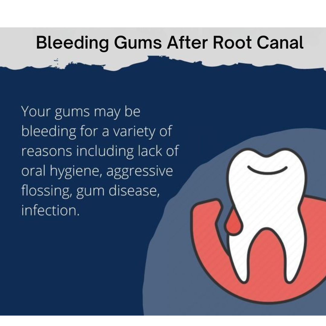 Bleeding Gums After Root Canal – Is It Normal?