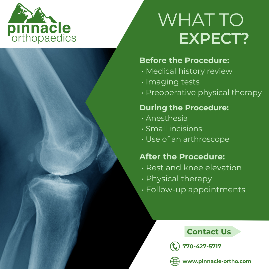 What to Expect from Knee Arthroscopy