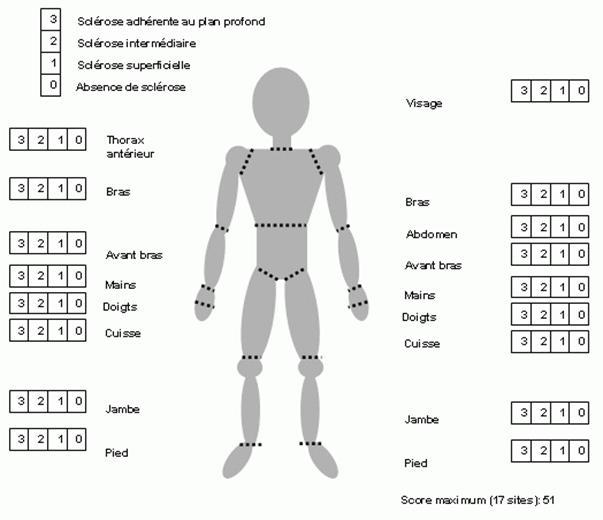 Tout sur la sclérodermie - Association des Patients Sclerodermiques de  Belgique -