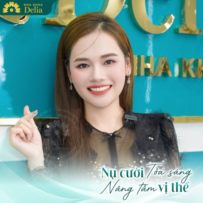 Mặt trái xoan phù hợp với dáng răng sứ nào?