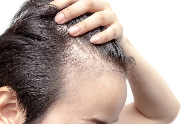 Types of Hair Loss that Needs Treatment
