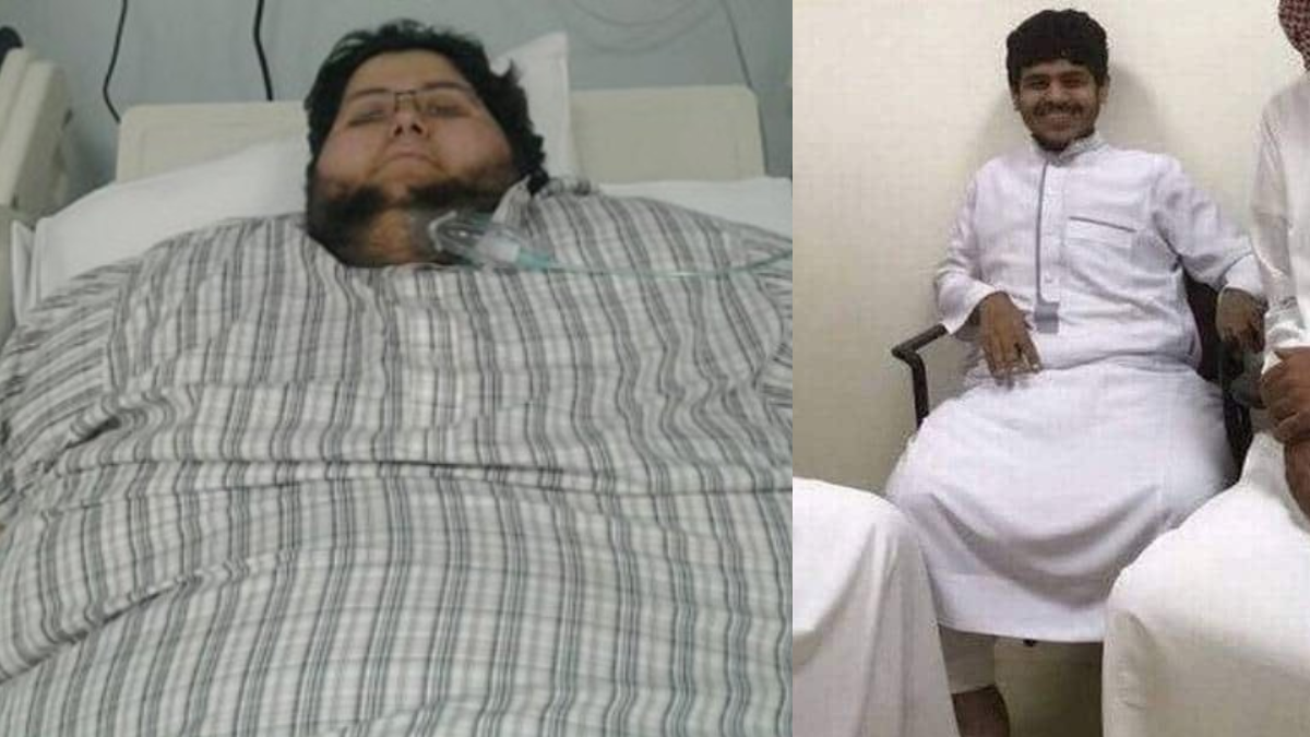 Heaviest Man Alive's Stunning Weight Loss Story