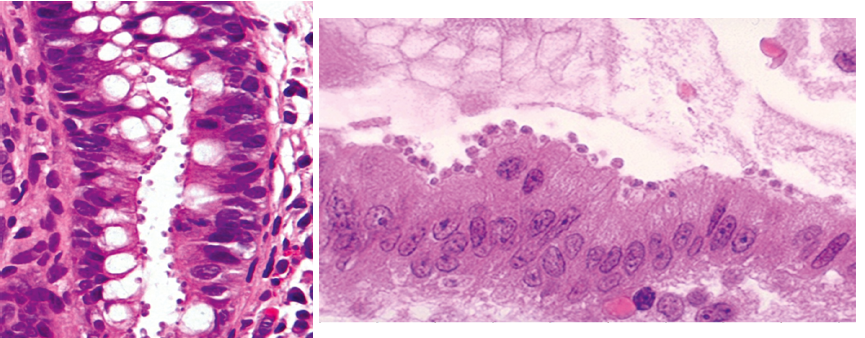 Cyclospora and Isospora