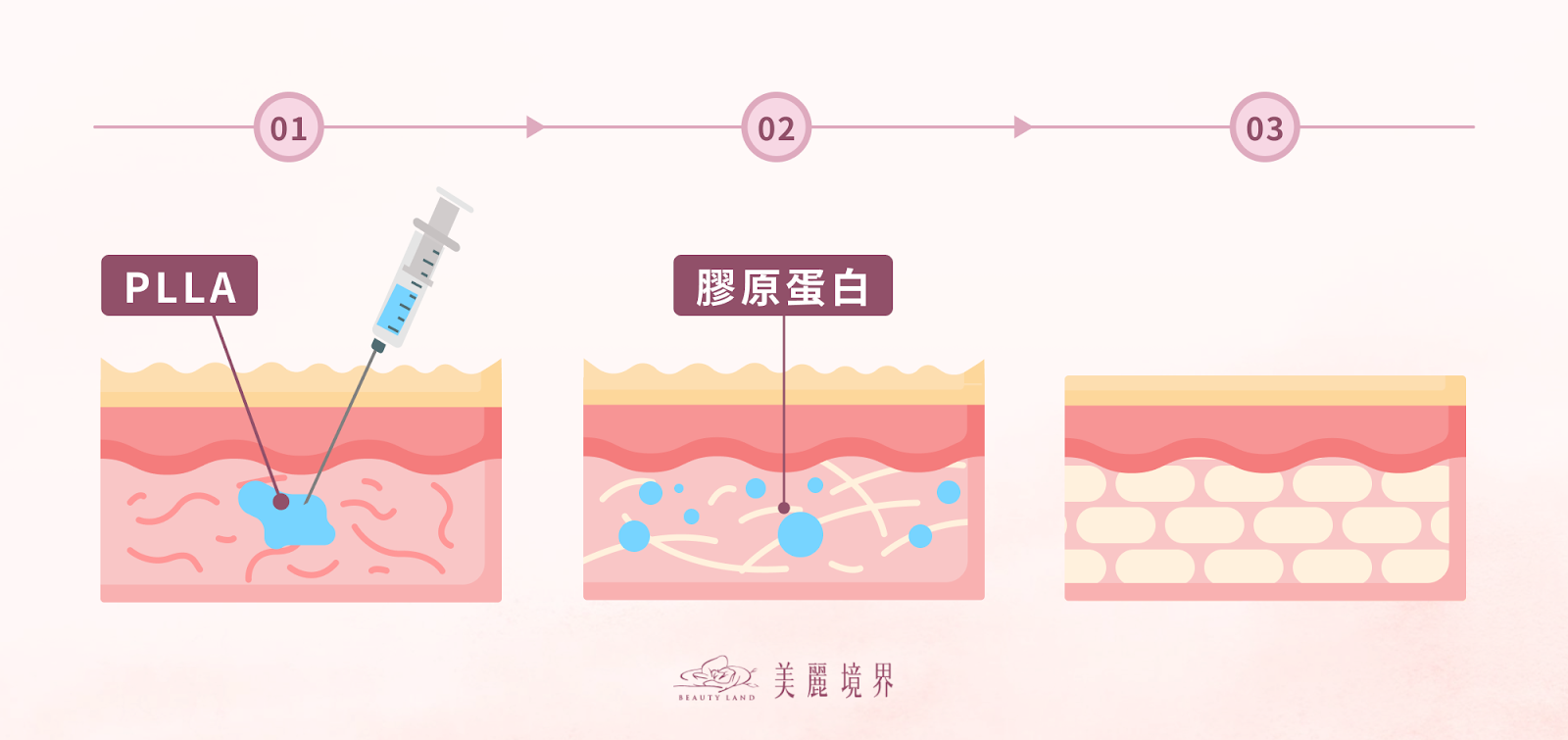 PLLA作用示意圖