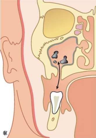 sinus2.png