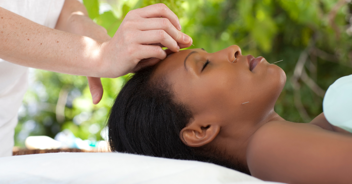 acupuncture points