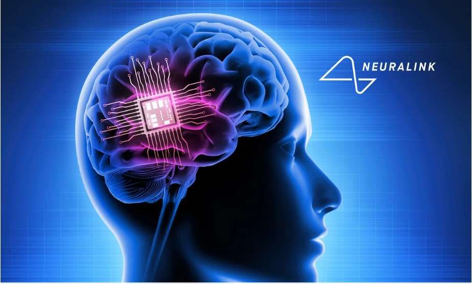 Neuralink: Inovasi Teknologi Implan Otak yang Mengubah Hidup