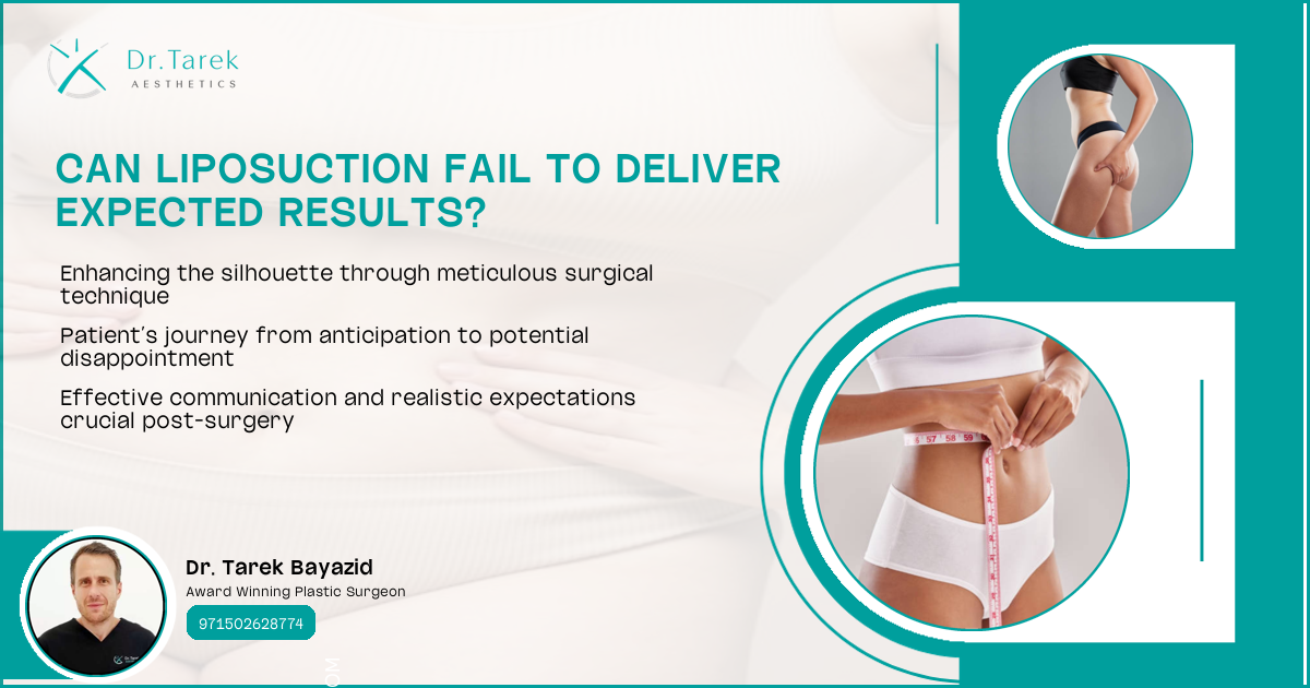 Can Liposuction Fail