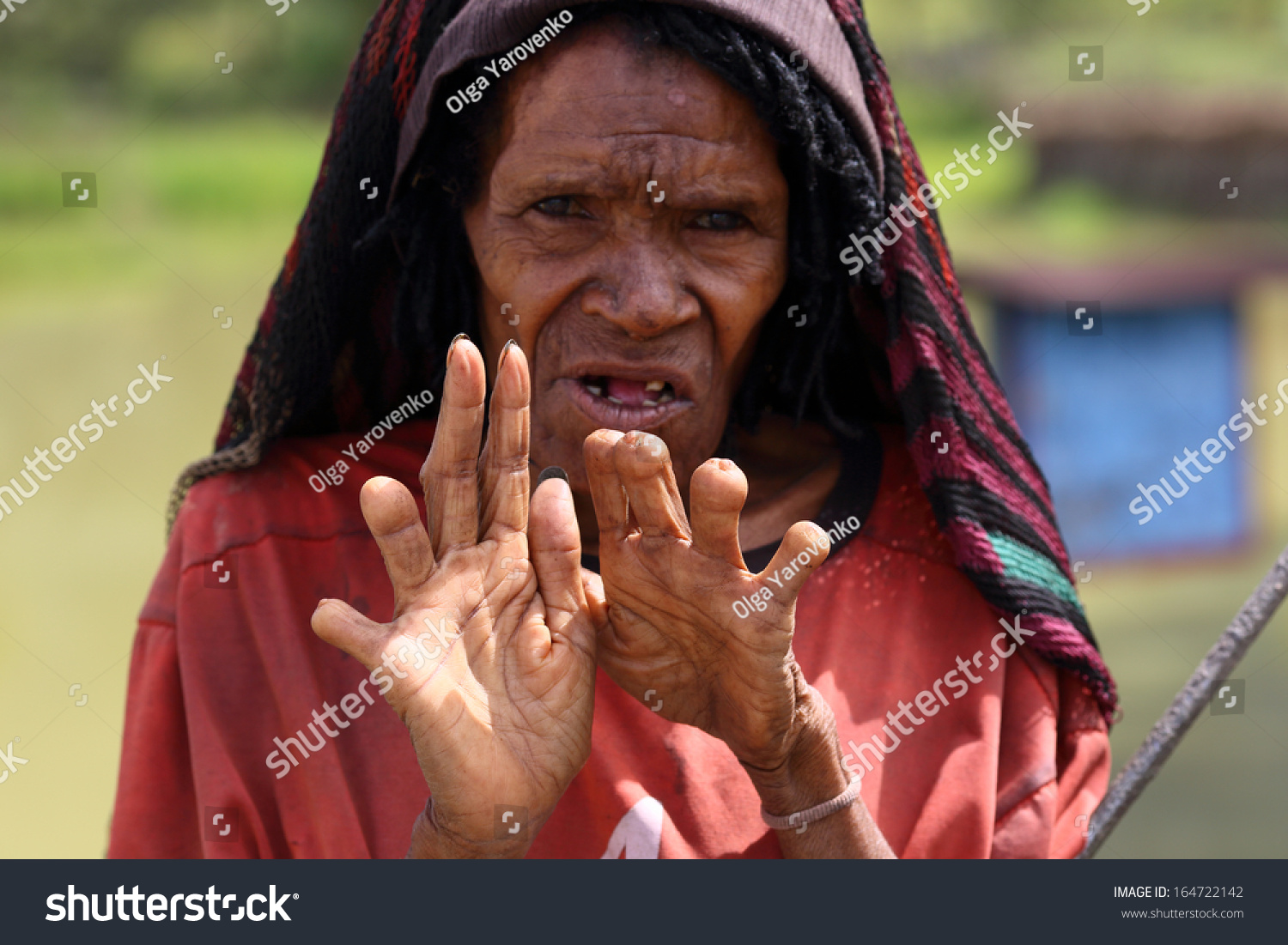 DUGUM DANI VILLAGE, BALIEM VALLEY, IRIAN JAYA, NEW GUINEA, INDONESIA - July 18, 2013  On July 18, 2013 in DUGUM Dani Village, New Guinea, Indonesia. A woman cut off her finger when a relative dies 