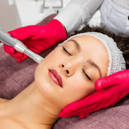 microneedling facial