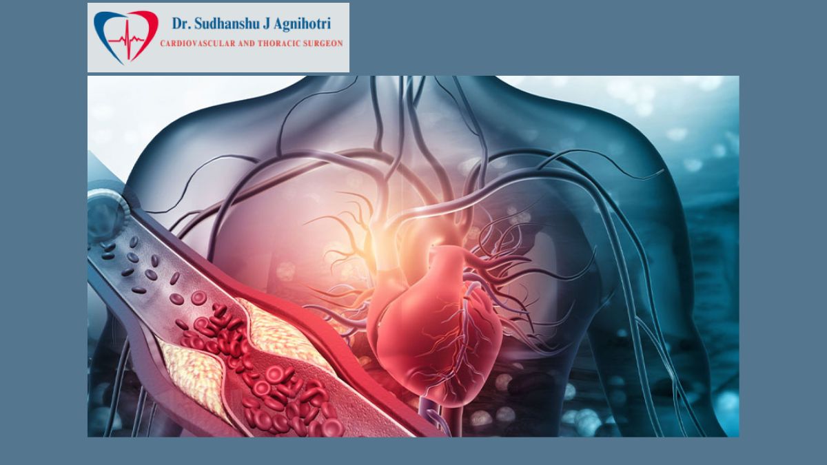 Invasive Cardiac Surgery by Dr Sudhanshu J Agnihotri - Best Cardiac Surgeon In Indore