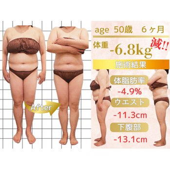 『運動しても、食事制限しても、なかなか痩せない！』_20250314_1