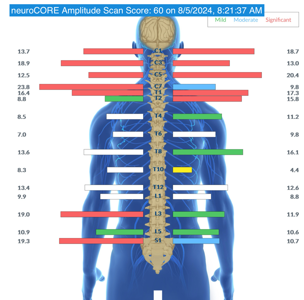 Understanding Your Child’s Motor Control (and Their Nervous System) | PX Docs