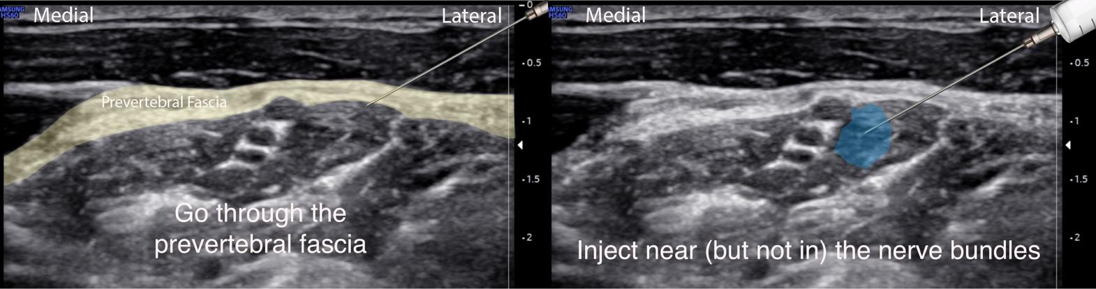 A close-up of an ultrasound

Description automatically generated