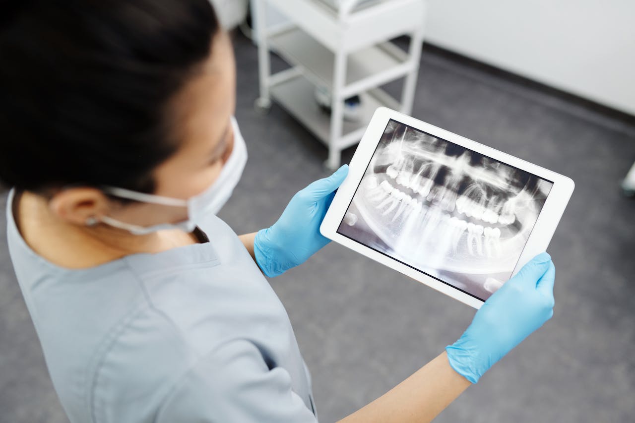 Dentista segurando um raio X da boca para mostrar que a radioterapia pode afetar a saúde bucal. 