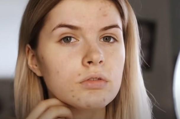 Hair and Skin Issues