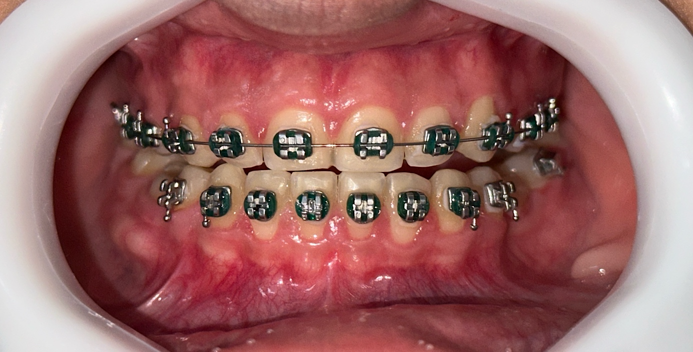 Uma imagem contendo no interior, pequeno, escova de dentes, segurando

Descrição gerada automaticamente