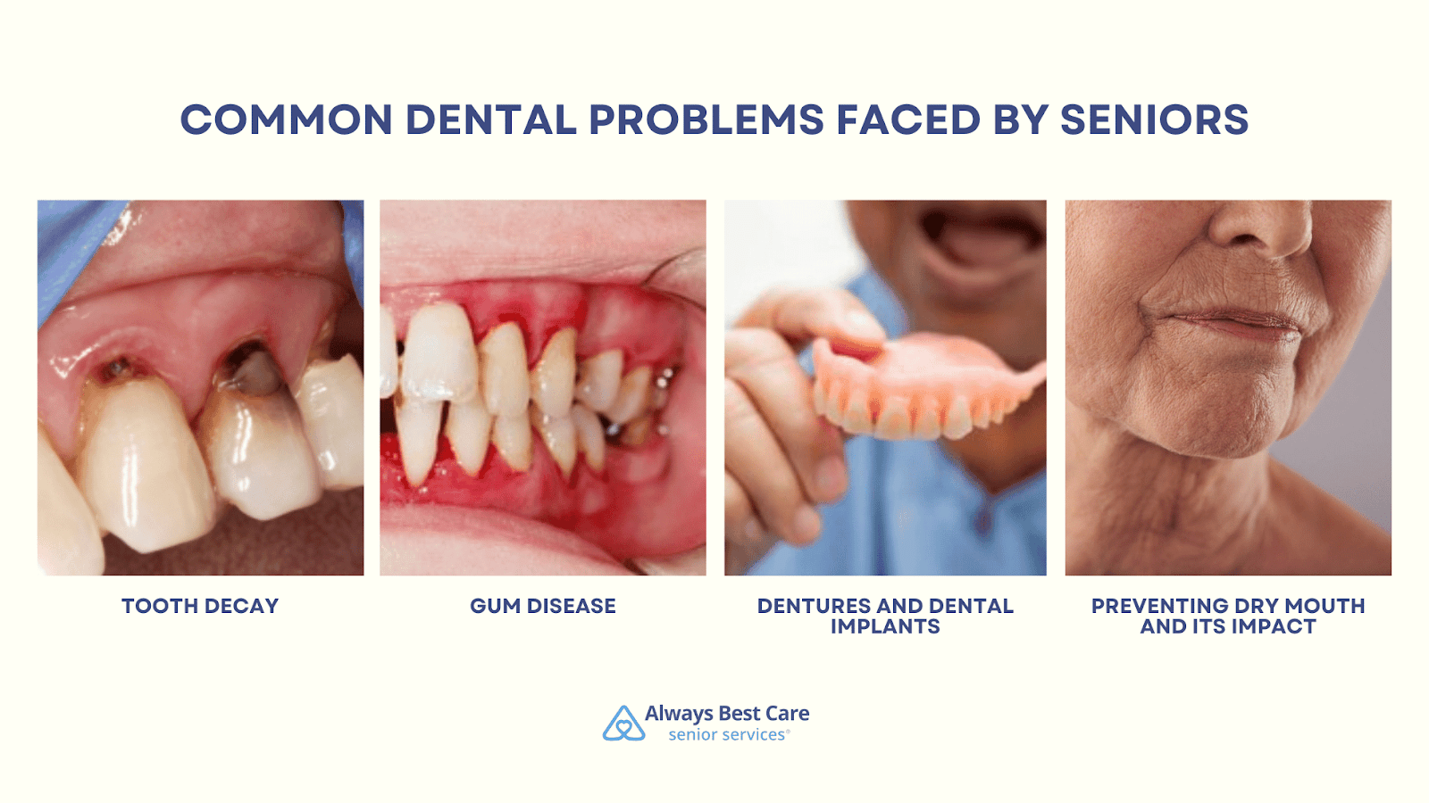 This is an infographic detailing the 4 common oral health problems in seniors