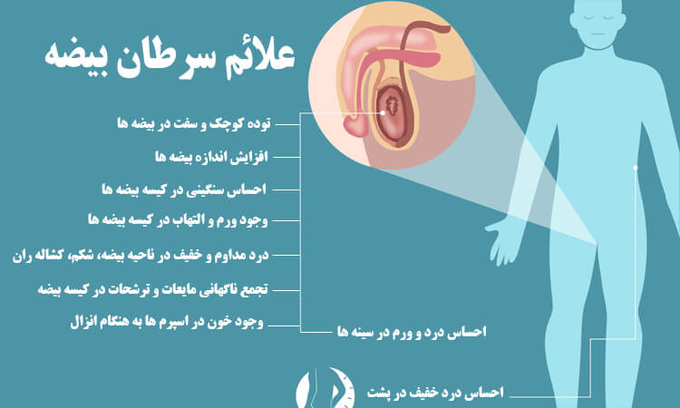 علائم سرطان بیضه