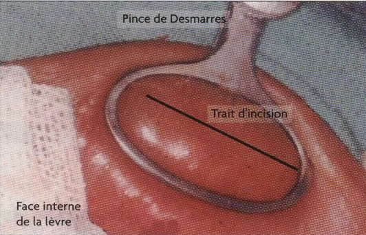 Exámenes biológicos en odontología