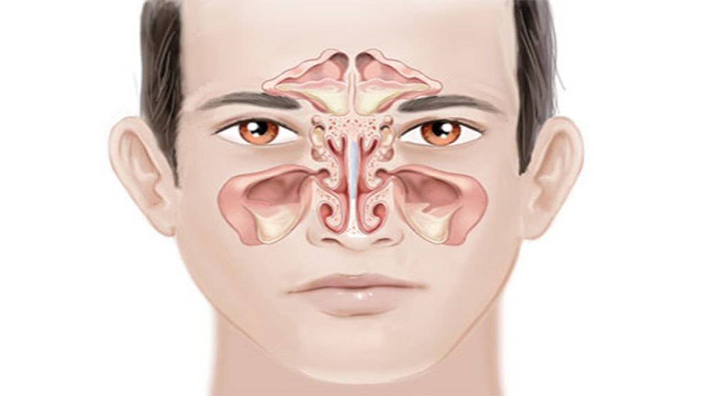  الجيوب الأنفية ما هي؟ وما وظيفتها؟ أهمَّ أسباب التهاب الجيوب الأنفية وطرق علاجها