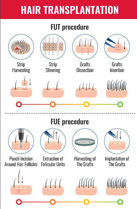 Difference between hair transplant and hair patching