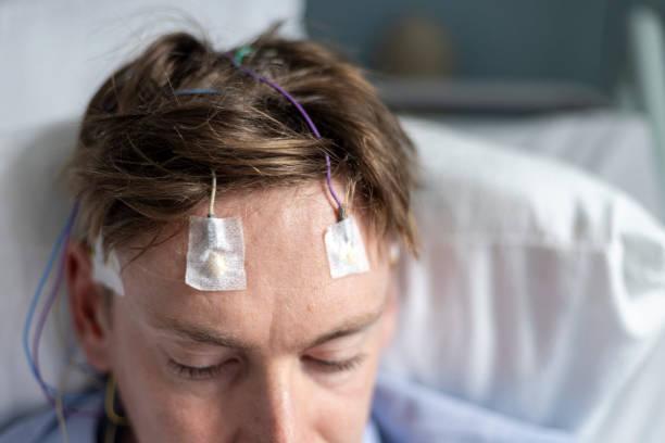 Brain Wave Study with Electrodes Close up of a man in a hospital bed having a brain study done to investigate his sleep seizures. He is staying at a medical establishment in the North East of England and has multiple electrodes monitoring his scalp.

Videos are available similar to this scenario. Neurofeedback Devices stock pictures, royalty-free photos & images