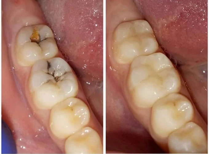 Dental Care Trends in CTM