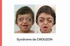 C:\Users\User\Desktop\crouson.jpg