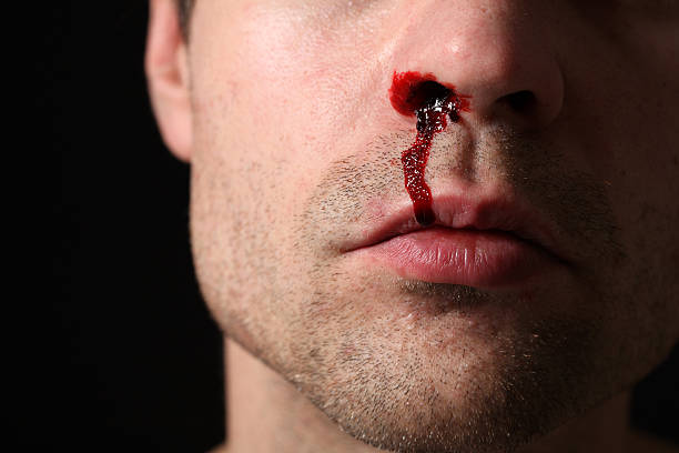 Can Creatine Cause Nose Bleeds? combat creatine