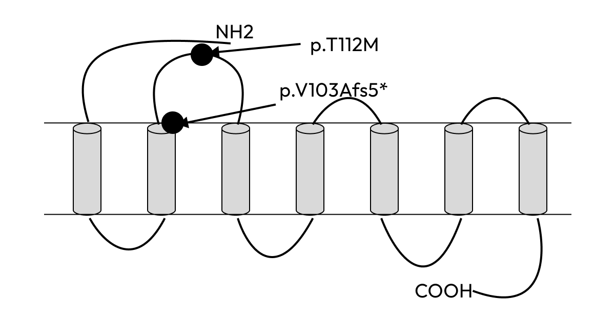 Gene Selection: Targeting Key Genes Responsible for Obesity