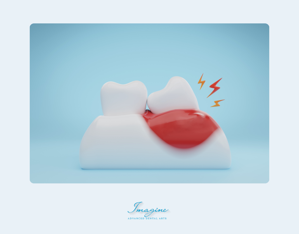 What Is Gum Disease?