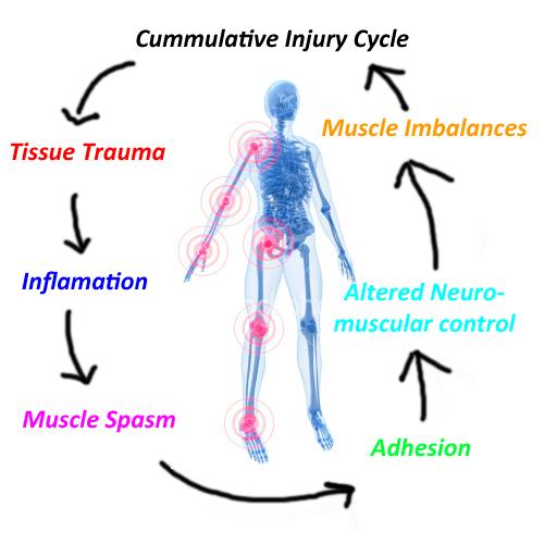 image of skeleton with stages of cummulative injury cycle