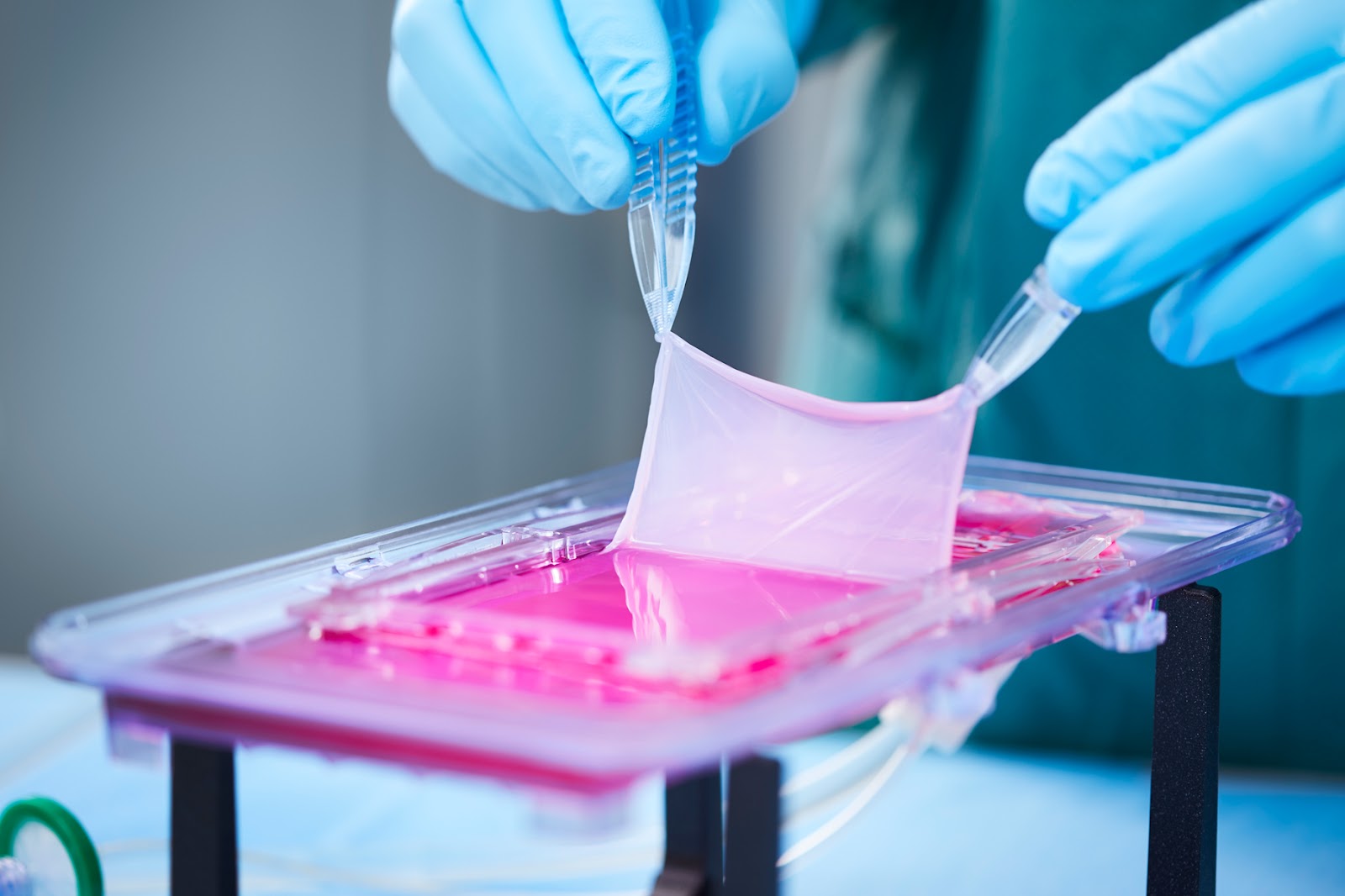 Example of Regeneration in Medicine