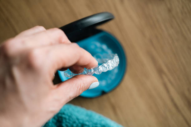 How Does Invisalign Work in Concord Mills near Charlotte, NC?