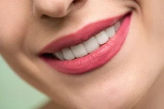 A close-up of a woman's smile showcasing bright, perfectly aligned teeth, emphasizing the results of cosmetic dental treatments