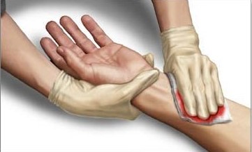 STOP THE BLEED: Setiap Detik Berharga, Apa yang Bisa Kita Lakukan?