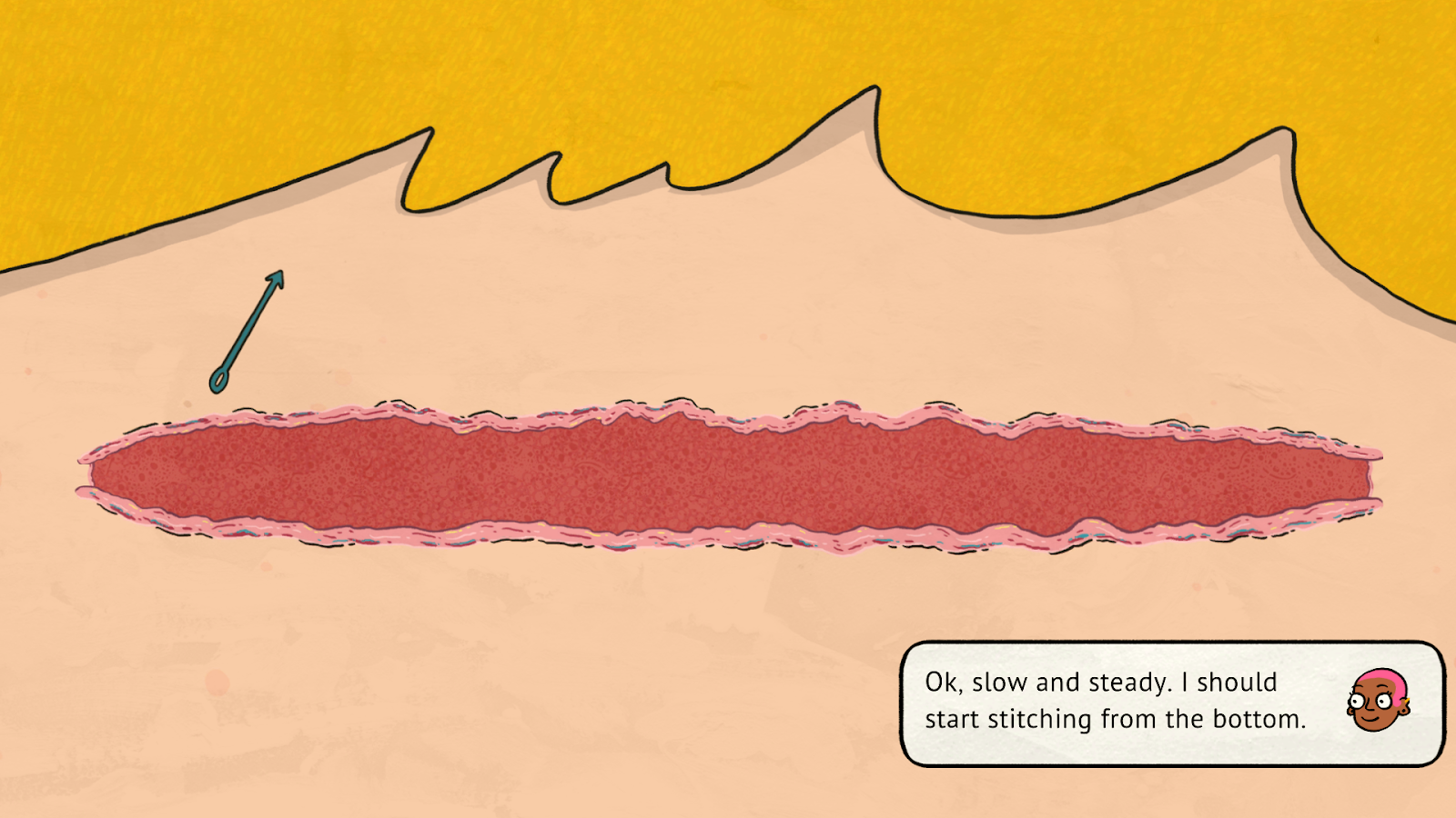 A screenshot from the minigame where you stitch up a wound.