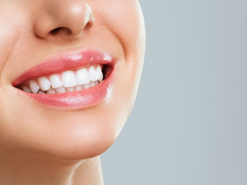 clareamento dental a laser benefícios