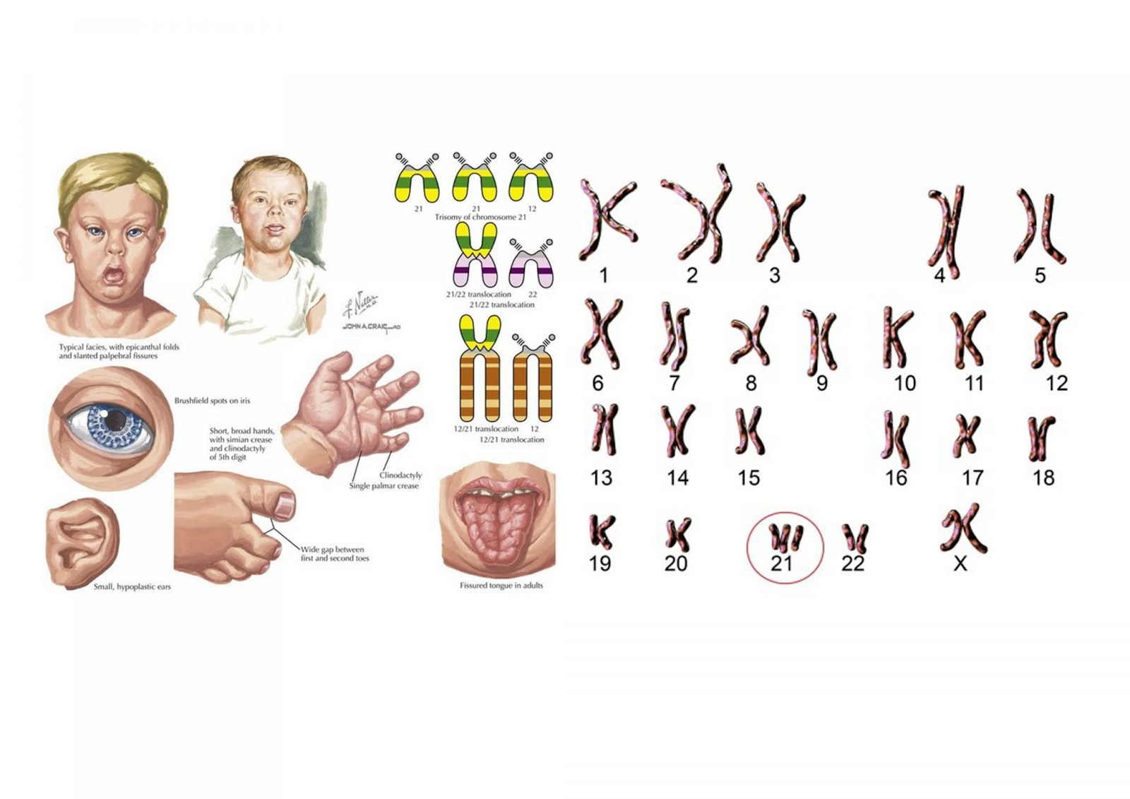 BÀI 6: ĐỘT BIẾN NHIỄM SẮC THỂ