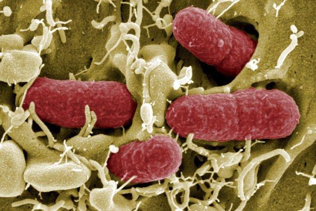 El zinc modula la virulencia de la "Escherichia coli" - COFA