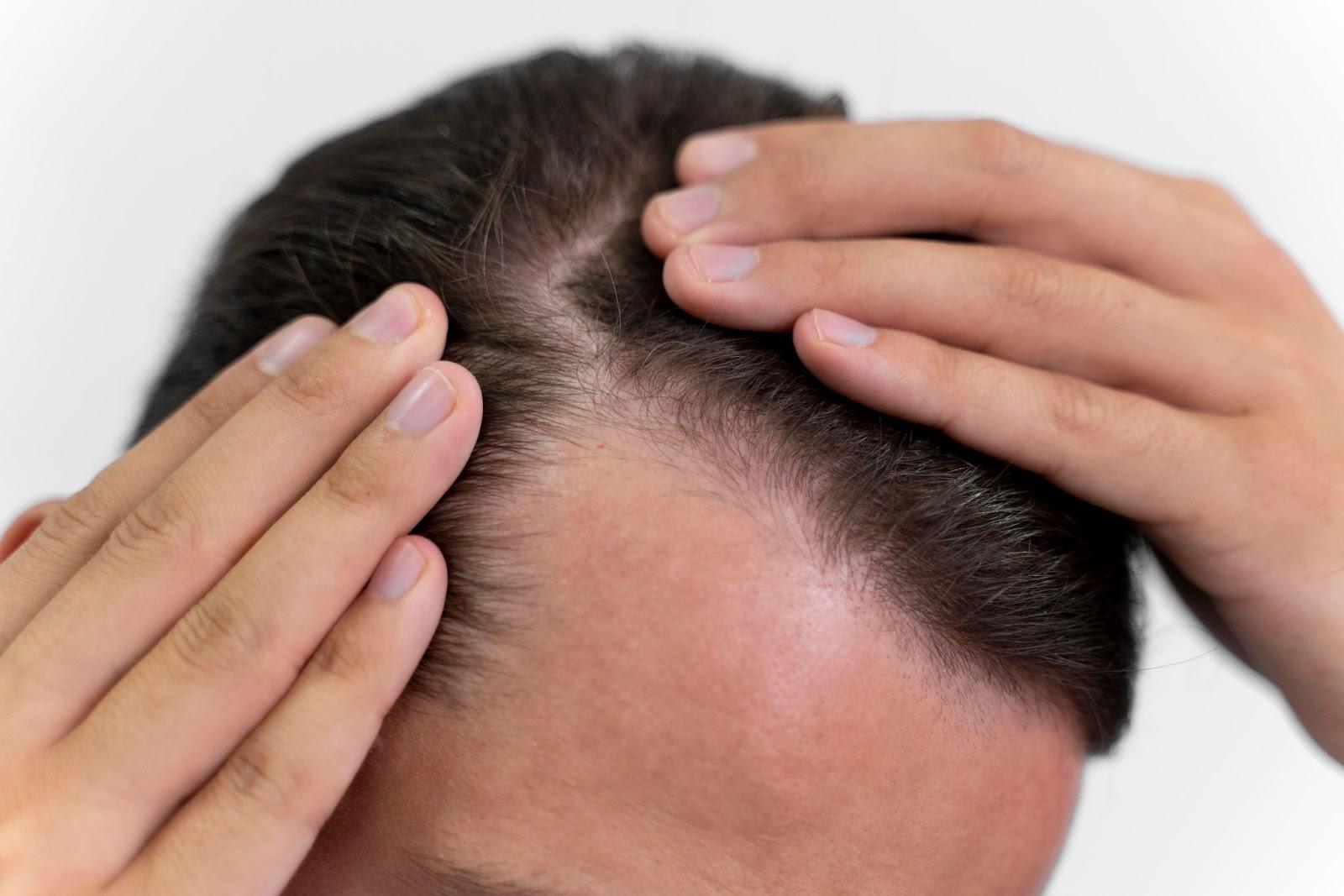 A person holding their head

AI-generated content may be incorrect.