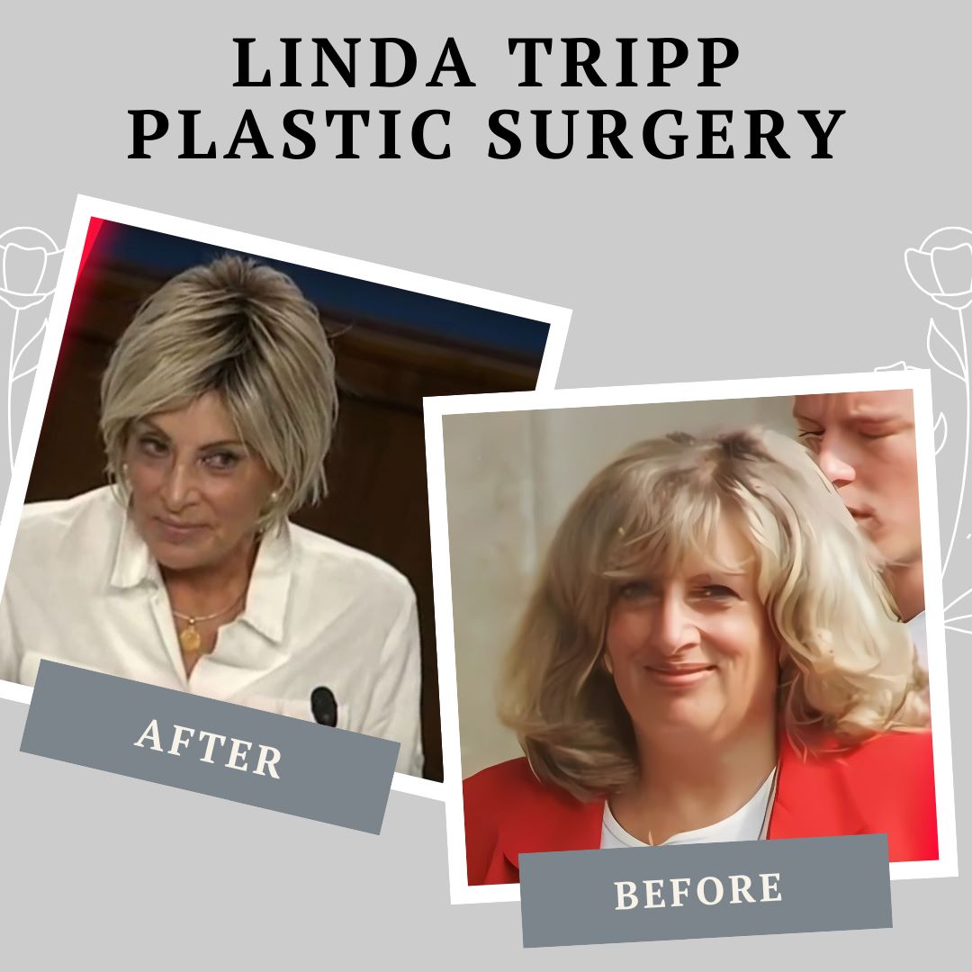 Linda Tripp Plastic Surgery