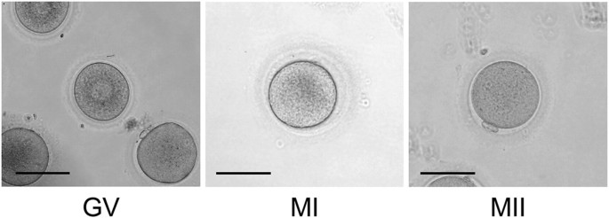 GV, M1 and M2 stage of oocytes